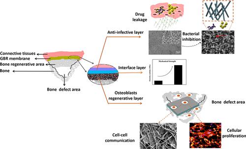 电纺构建的新型三层膜可用作口腔骨再生的生物相容性支架