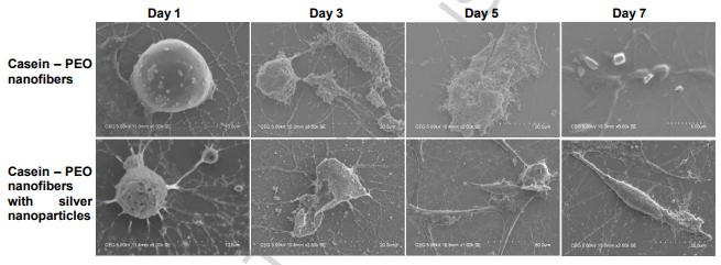 Int. J. Biol. Macromol.：电纺负载银纳米粒子的酪蛋白纳米纤维用于生物医学
